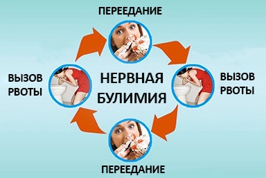 Лечение булимии в Новодвинске